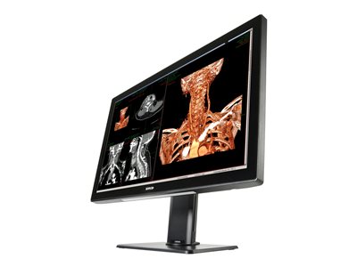 Barco Coronis Fusion 6MP 1H Color Medical Display System