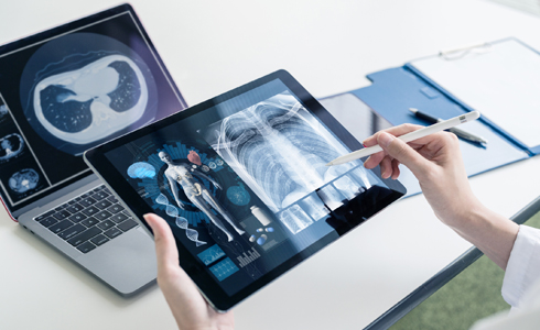 Telehealth: healthcare provider holding a tablet with an xray